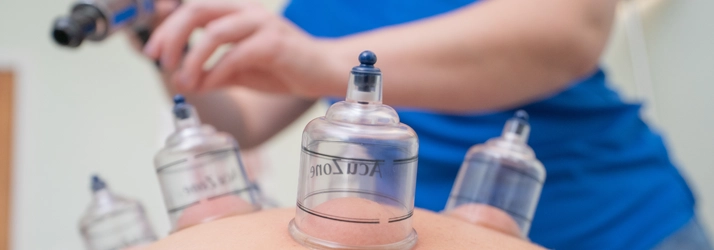 Cupping therapy on patient's back
