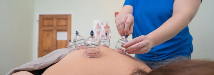 Cupping therapy being performed on patient's back